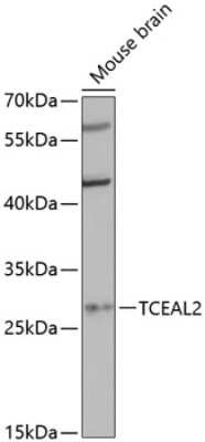 Western Blot: TCEAL2 AntibodyAzide and BSA Free [NBP2-93624]