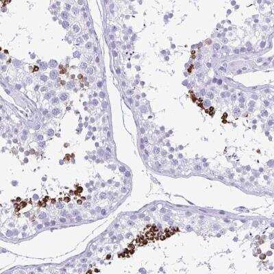 Immunohistochemistry: TCEAL3 Antibody [NBP2-46855]