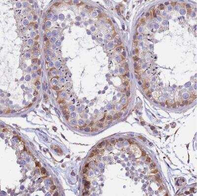 Immunohistochemistry-Paraffin: TCEAL5 Antibody [NBP2-54723]