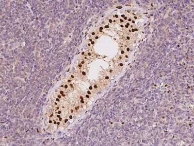 Immunohistochemistry-Paraffin: TCEAL3 Antibody [NBP2-98537]