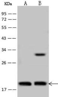 Western Blot: TCEAL3 Antibody [NBP2-98537]