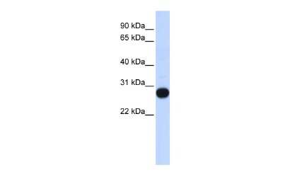 Western Blot: TCEAL4 Antibody [NBP2-84293]