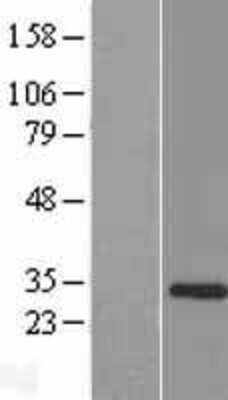 Western Blot: TCEAL5 Overexpression Lysate [NBP2-08712]