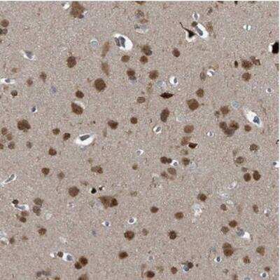 Immunohistochemistry: TCEAL7 Antibody [NBP2-30974]