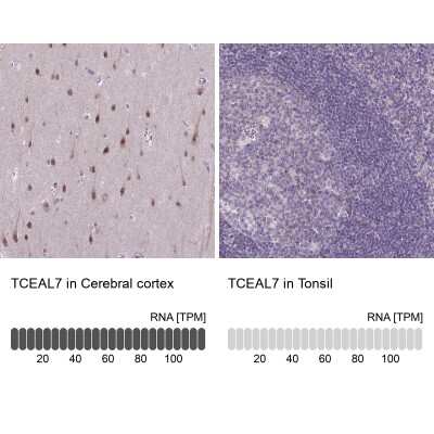 Immunohistochemistry-Paraffin: TCEAL7 Antibody [NBP2-30974]