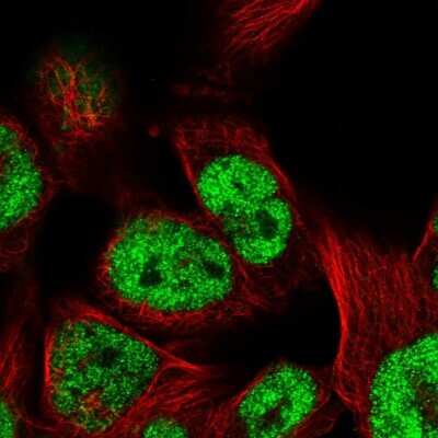 Immunocytochemistry/ Immunofluorescence: TCEAL8 Antibody [NBP2-32425]