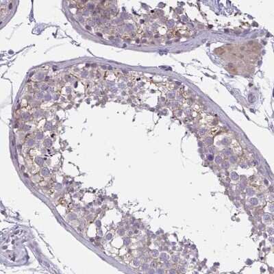 Immunohistochemistry-Paraffin: TCEAL8 Antibody [NBP2-32425]