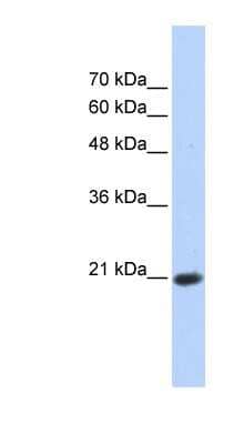 Western Blot: TCEAL8 Antibody [NBP1-79349]