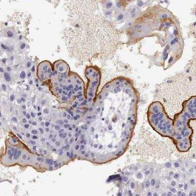 Immunohistochemistry-Paraffin: TCEANC Antibody [NBP1-81184]