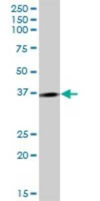 Western Blot: TCEANC Antibody [H00170082-B01P]