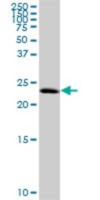 Western Blot: TCEANC2 Antibody [H00127428-B01P]