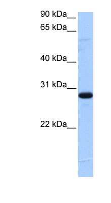 Western Blot: TCEANC2 Antibody [NBP1-79423]