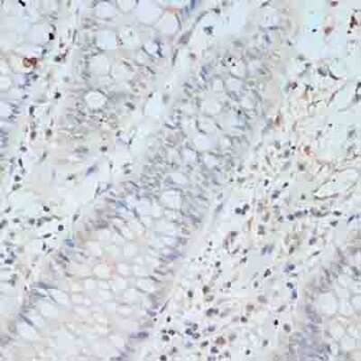 Immunohistochemistry-Paraffin: TCEB2 Antibody - BSA Free [NBP2-94034]