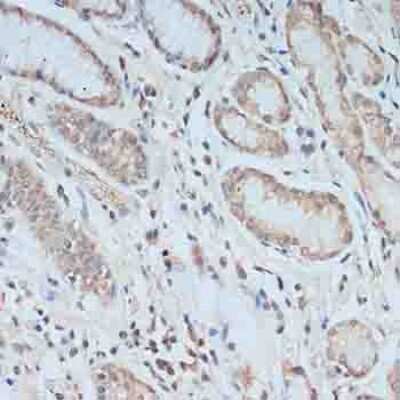 Immunohistochemistry-Paraffin: TCEB2 Antibody - BSA Free [NBP2-94034]