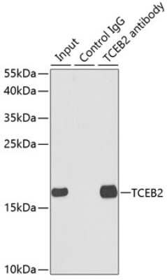 Immunohistochemistry-Paraffin: TCEB2 Antibody - BSA Free [NBP2-94149]