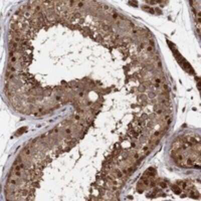 Immunohistochemistry-Paraffin: TCEB2 Antibody [NBP3-17944]