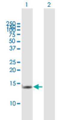 Western Blot: TCEB2 Antibody [H00006923-B01P]