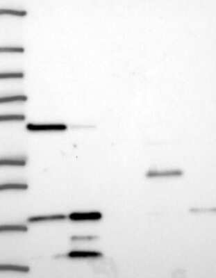 Western Blot: TCEB2 Antibody [NBP3-17944]