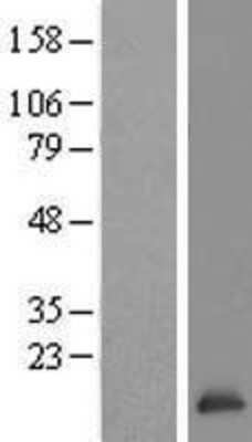 Western Blot: TCEB2 Overexpression Lysate [NBL1-16766]