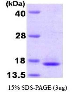 SDS-PAGE: Recombinant Human TCEB2 Protein [NBC1-22579]