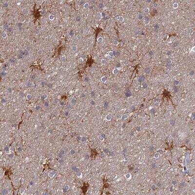 Immunohistochemistry-Paraffin: TCEB3B Antibody [NBP1-92483]