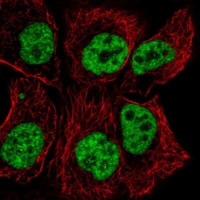 Immunocytochemistry/ Immunofluorescence: TCERG1 Antibody [NBP2-55769]