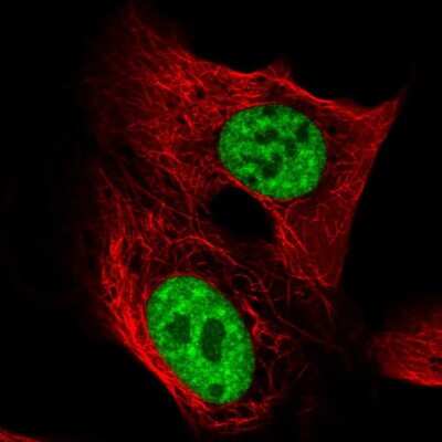 Immunocytochemistry/ Immunofluorescence: TCERG1 Antibody [NBP2-57767]