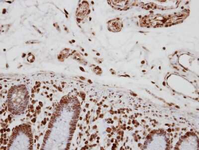 Immunohistochemistry-Paraffin: TCERG1 Antibody [NBP2-20584]