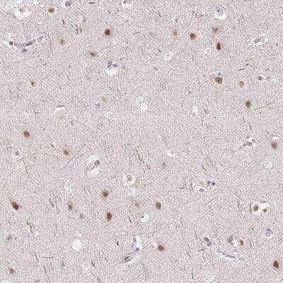 Immunohistochemistry-Paraffin: TCERG1 Antibody [NBP2-39037]