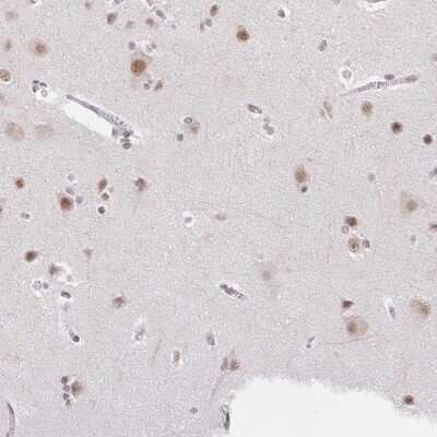 Immunohistochemistry-Paraffin: TCERG1 Antibody [NBP2-39037]
