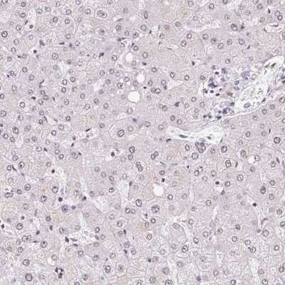 Immunohistochemistry-Paraffin: TCERG1 Antibody [NBP2-39037]