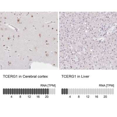 Immunohistochemistry-Paraffin: TCERG1 Antibody [NBP2-39037]