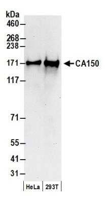 Western Blot: TCERG1 Antibody [NB300-214]