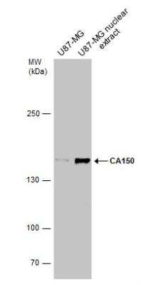 Western Blot: TCERG1 Antibody [NBP2-20584]