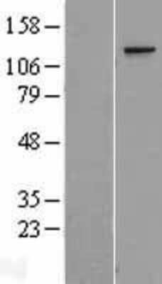 Western Blot: TCERG1 Overexpression Lysate [NBP2-08539]