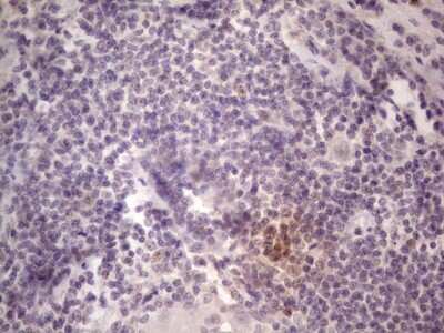 Immunohistochemistry: TCF-12/HTF4 Antibody (OTI4D6) [NBP2-46086]