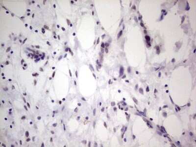 Immunohistochemistry: TCF-12/HTF4 Antibody (OTI4D6) [NBP2-46086]