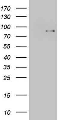 Western Blot: TCF-12/HTF4 Antibody (OTI4D6) [NBP2-46086]