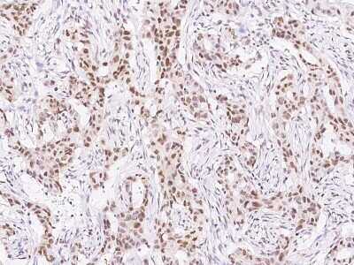 Immunohistochemistry-Paraffin: TCF-12/HTF4 Antibody [NBP2-99046]