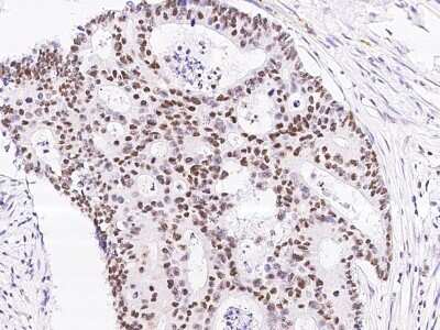 Immunohistochemistry-Paraffin: TCF-12/HTF4 Antibody [NBP2-99046]