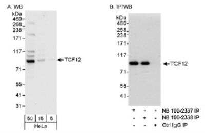 Western Blot: TCF-12/HTF4 Antibody [NB100-2337]