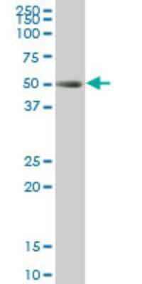 Western Blot: TCF-2/HNF-1 beta Antibody (3E11) [H00006928-M02]