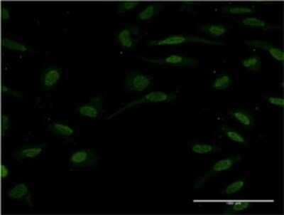Immunocytochemistry/ Immunofluorescence: TCF-2/HNF-1 beta Antibody (3H4) [H00006928-M01]