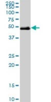 Western Blot: TCF-2/HNF-1 beta Antibody (3H4) [H00006928-M01]