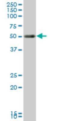 Western Blot: TCF-2/HNF-1 beta Antibody (3H4) [H00006928-M01]