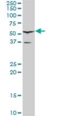 Western Blot: TCF-2/HNF-1 beta Antibody (4E9) [H00006928-M06]