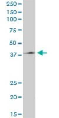 Western Blot: TCF-2/HNF-1 beta Antibody (4E9) [H00006928-M06]