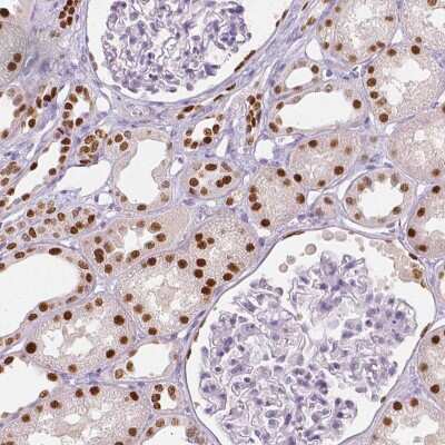 Immunohistochemistry-Paraffin: TCF-2/HNF-1 beta Antibody (CL0374) [NBP2-30678]