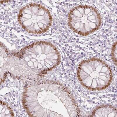 Immunohistochemistry-Paraffin: TCF-2/HNF-1 beta Antibody (CL0374) [NBP2-30678]