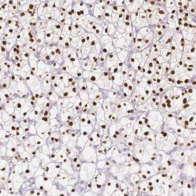 Immunohistochemistry-Paraffin: TCF-2/HNF-1 beta Antibody (CL0374) [NBP2-30678]